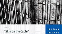 “Skin on the Cable”  The Illegal Arrest, Arbitrary Detention and Torture of People Who Use Drugs in Cambodia January 25, 2010 In this 93-page report Human Rights Watch documents detainees […]